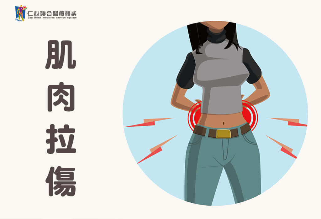 肌肉拉傷